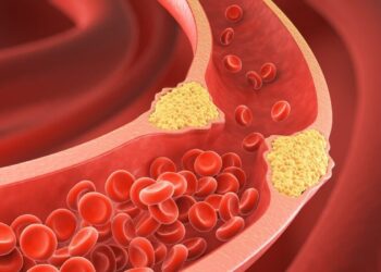 When combating excessive blood cholesterol